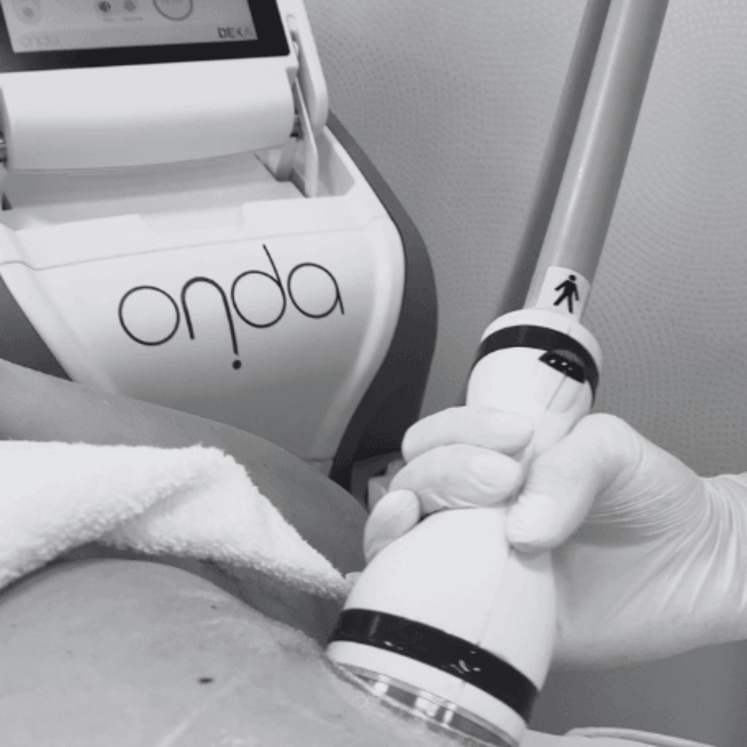 Onda Coolwaves – nowoczesna technologia modelowania sylwetki. Postaw na skuteczność w swoim gabinecie beauty